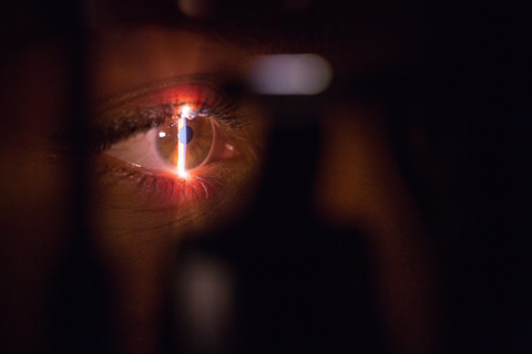 LASIK eye